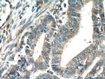 ADAM12 Antibody in Immunohistochemistry (Paraffin) (IHC (P))