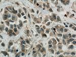 Fibrillin 1 Antibody in Immunohistochemistry (Paraffin) (IHC (P))