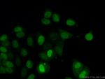 Cyclin D1 Antibody in Immunocytochemistry (ICC/IF)