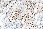 Cyclin D1 Antibody in Immunohistochemistry (Paraffin) (IHC (P))