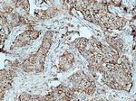 F11R Antibody in Immunohistochemistry (Paraffin) (IHC (P))