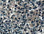 IARS Antibody in Immunohistochemistry (Paraffin) (IHC (P))