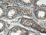 IARS Antibody in Immunohistochemistry (Paraffin) (IHC (P))