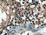 IARS Antibody in Immunohistochemistry (Paraffin) (IHC (P))