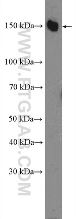 IARS Antibody in Western Blot (WB)