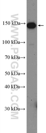 IARS Antibody in Western Blot (WB)