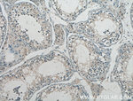 GnRH Antibody in Immunohistochemistry (Paraffin) (IHC (P))