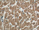 Perilipin 5 Antibody in Immunohistochemistry (Paraffin) (IHC (P))