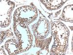 Bcl-XL Antibody in Immunohistochemistry (Paraffin) (IHC (P))