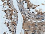 Bcl-XL Antibody in Immunohistochemistry (Paraffin) (IHC (P))