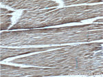 RYR1 Antibody in Immunohistochemistry (Paraffin) (IHC (P))