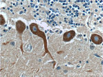 RYR1 Antibody in Immunohistochemistry (Paraffin) (IHC (P))