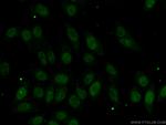 DNMT3B Antibody in Immunocytochemistry (ICC/IF)