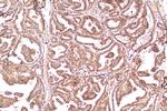 CITED1 Antibody in Immunohistochemistry (Paraffin) (IHC (P))