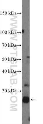 CITED1 Antibody in Western Blot (WB)