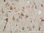 LRRTM3 Antibody in Immunohistochemistry (Paraffin) (IHC (P))