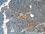 CRELD2 Antibody in Immunohistochemistry (Paraffin) (IHC (P))