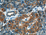 CRELD2 Antibody in Immunohistochemistry (Paraffin) (IHC (P))