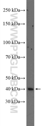 CRELD2 Antibody in Western Blot (WB)