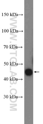 CRELD2 Antibody in Western Blot (WB)