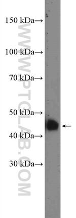 CRELD2 Antibody in Western Blot (WB)