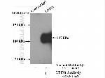 LPIN1 Antibody in Immunoprecipitation (IP)