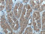 PI 3 Kinase p55 gamma Antibody in Immunohistochemistry (Paraffin) (IHC (P))