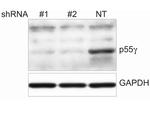 PI 3 Kinase p55 gamma Antibody in Western Blot (WB)