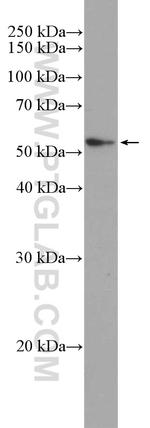 PI 3 Kinase p55 gamma Antibody in Western Blot (WB)