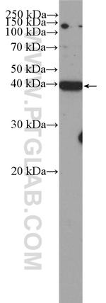 CDK5R2/p39 Antibody in Western Blot (WB)