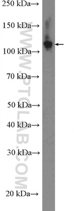 RAD21 Antibody in Western Blot (WB)