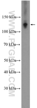 RAD21 Antibody in Western Blot (WB)