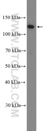 RAD21 Antibody in Western Blot (WB)