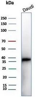 CD57/B3GAT1 (Natural Killer Cell Marker) Antibody in Western Blot (WB)