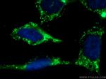 RAB10 Antibody in Immunocytochemistry (ICC/IF)