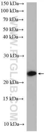 RAB10 Antibody in Western Blot (WB)