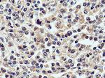 CXCL8/IL8 Antibody in Immunohistochemistry (Paraffin) (IHC (P))