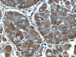 ITGAV Antibody in Immunohistochemistry (Paraffin) (IHC (P))