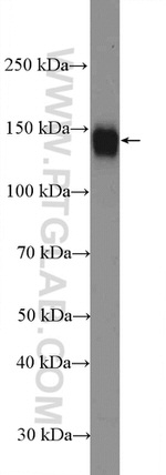 ITGAV Antibody in Western Blot (WB)