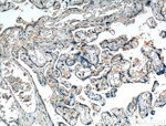 FGF3 Antibody in Immunohistochemistry (Paraffin) (IHC (P))