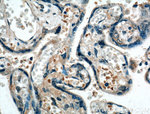 FGF3 Antibody in Immunohistochemistry (Paraffin) (IHC (P))