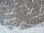 FGF3 Antibody in Immunohistochemistry (Paraffin) (IHC (P))