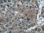 FGF3 Antibody in Immunohistochemistry (Paraffin) (IHC (P))