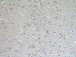 KCNK4 Antibody in Immunohistochemistry (Paraffin) (IHC (P))