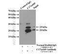 C17orf49 Antibody in Immunoprecipitation (IP)