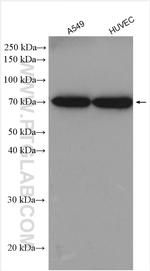 ADAM15 Antibody in Western Blot (WB)