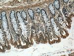 CARMIL Antibody in Immunohistochemistry (Paraffin) (IHC (P))