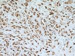 SGSM3 Antibody in Immunohistochemistry (Paraffin) (IHC (P))