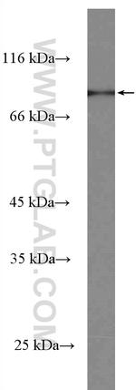 SGSM3 Antibody in Western Blot (WB)