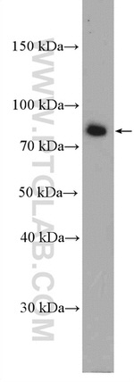 SGSM3 Antibody in Western Blot (WB)